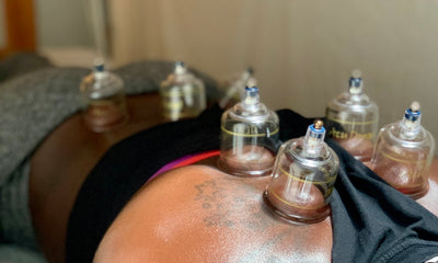 Acupuncture. Cupping. What's it all about?